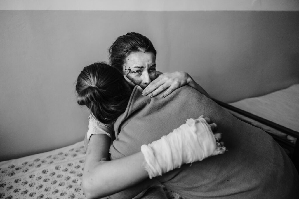 En ung ukrainska med bandagerad arm kramas om av sin mamma på sjukhuset.